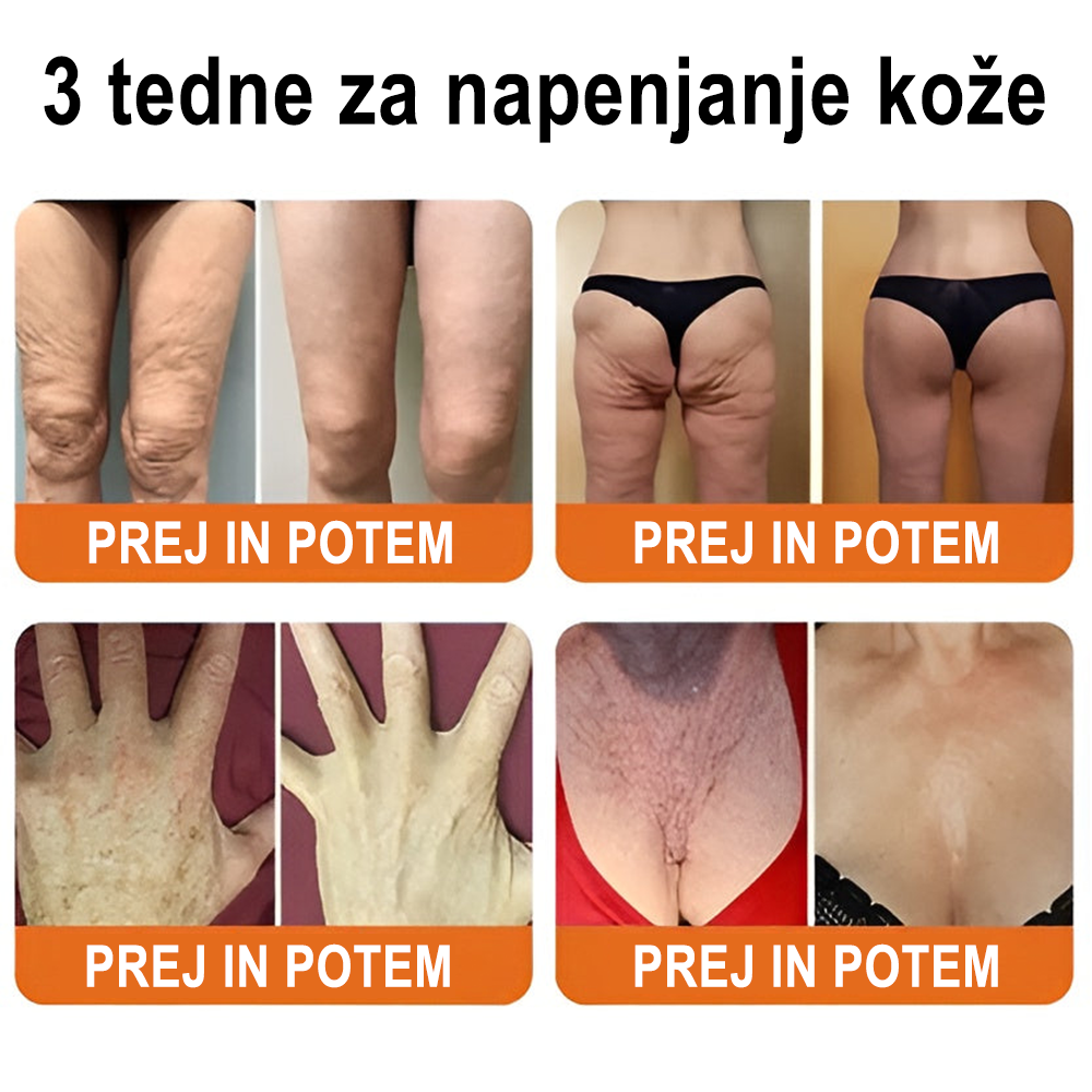 ✨ ZödVita® krema za obnovo kože s čebeljim strupom 🔥 Naravno sredstvo proti staranju, učvrsti kožo, zmanjša gube – 50 ml