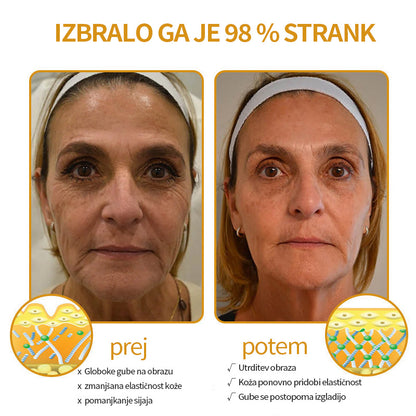 🔥Zadnji dan razprodaje: 70 % popust - krema proti gubam Purelora® Botox s čebeljim strupom