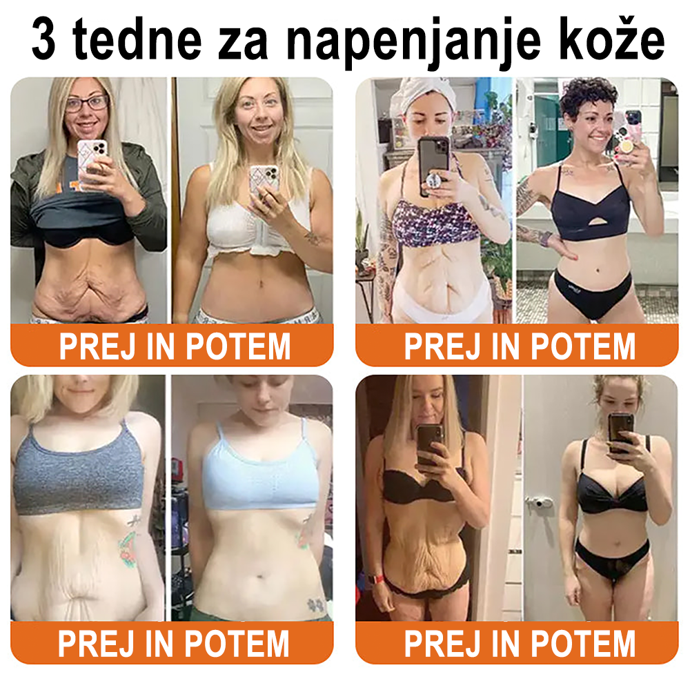 ✨ ZödVita® krema za obnovo kože s čebeljim strupom 🔥 Naravno sredstvo proti staranju, učvrsti kožo, zmanjša gube – 50 ml