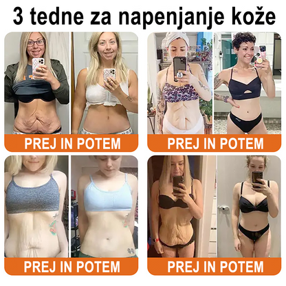 ✨ ZödVita® krema za obnovo kože s čebeljim strupom 🔥 Naravno sredstvo proti staranju, učvrsti kožo, zmanjša gube – 50 ml