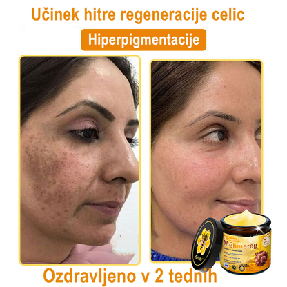 ✨ ZödVita® krema za obnovo kože s čebeljim strupom 🔥 Naravno sredstvo proti staranju, učvrsti kožo, zmanjša gube – 50 ml