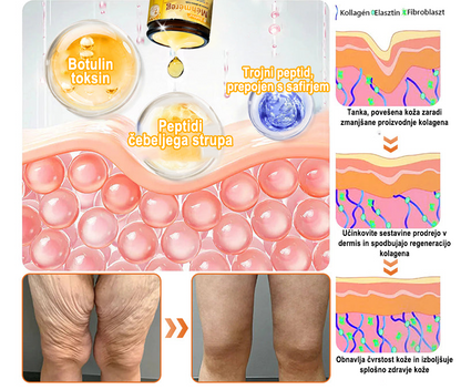 ✨ ZödVita® krema za obnovo kože s čebeljim strupom 🔥 Naravno sredstvo proti staranju, učvrsti kožo, zmanjša gube – 50 ml