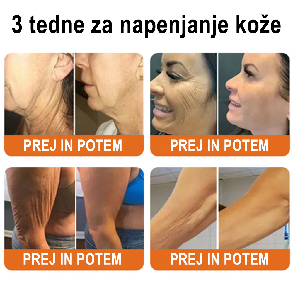 ✨ ZödVita® krema za obnovo kože s čebeljim strupom 🔥 Naravno sredstvo proti staranju, učvrsti kožo, zmanjša gube – 50 ml