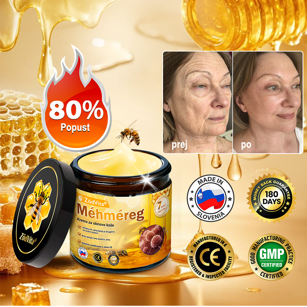 ✨ ZödVita® krema za obnovo kože s čebeljim strupom 🔥 Naravno sredstvo proti staranju, učvrsti kožo, zmanjša gube – 50 ml