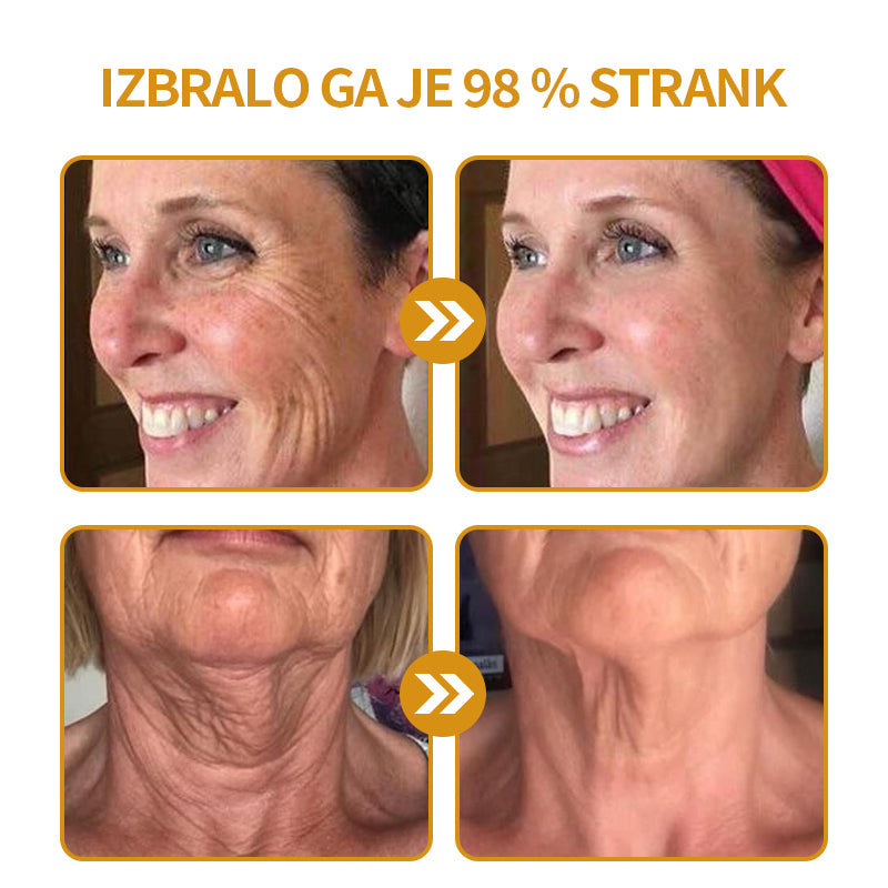 🔥Zadnji dan razprodaje: 70 % popust - krema proti gubam Purelora® Botox s čebeljim strupom