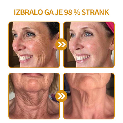 🔥Zadnji dan razprodaje: 70 % popust - krema proti gubam Purelora® Botox s čebeljim strupom