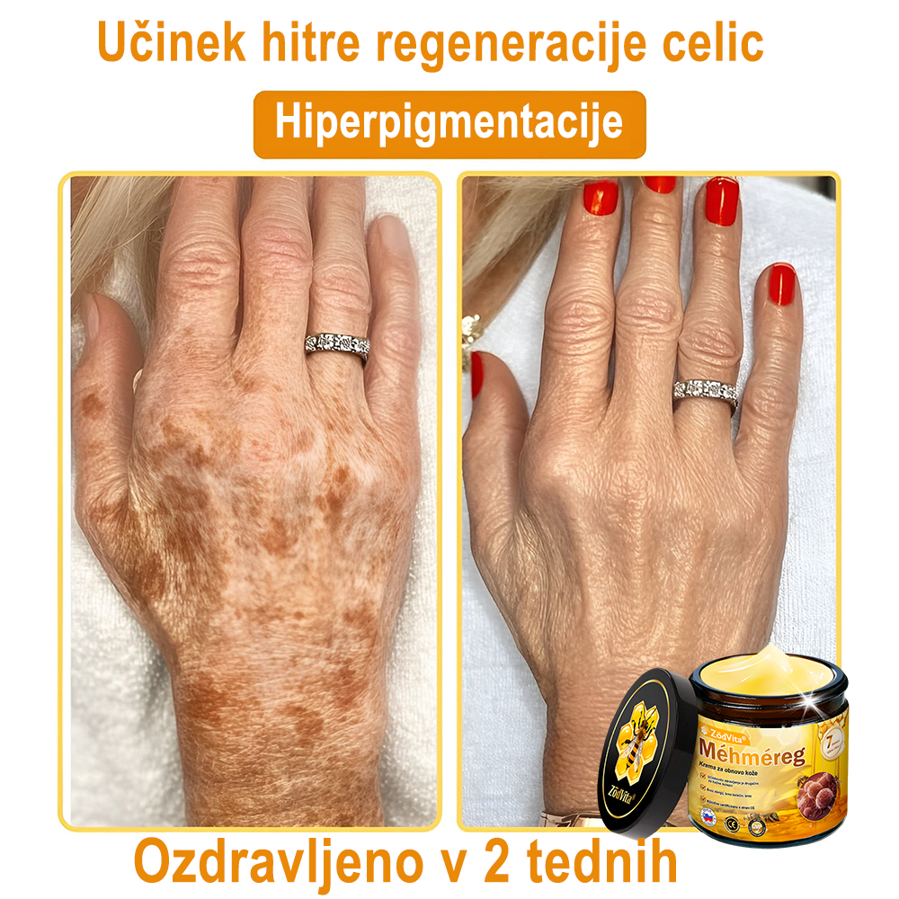 ✨ ZödVita® krema za obnovo kože s čebeljim strupom 🔥 Naravno sredstvo proti staranju, učvrsti kožo, zmanjša gube – 50 ml