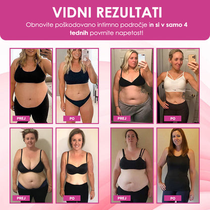 Curalona® takojšnje sredstvo za zaustavitev srbenja in razstrupljanje ter sredstvo za hujšanje in učvrstitev ter roza in nežne naravne kapsule PRO