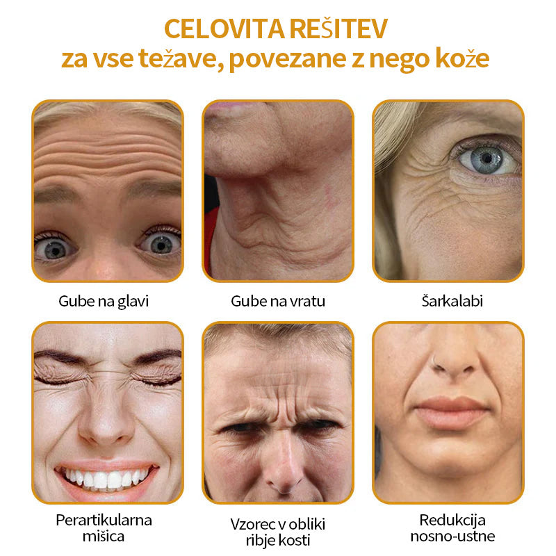 🔥Zadnji dan razprodaje: 70 % popust - krema proti gubam Purelora® Botox s čebeljim strupom