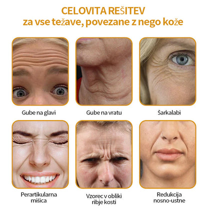 🔥Zadnji dan razprodaje: 70 % popust - krema proti gubam Purelora® Botox s čebeljim strupom