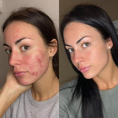💖【Uradna trgovina】PURELORA® AdaptaShade Foundation——Podlaga za prilagajanje barve kože z dodatki za nego kože